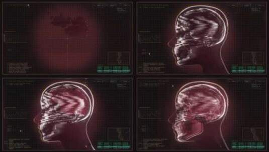 头骨，信息图，核磁共振扫描，神经学研究高清在线视频素材下载