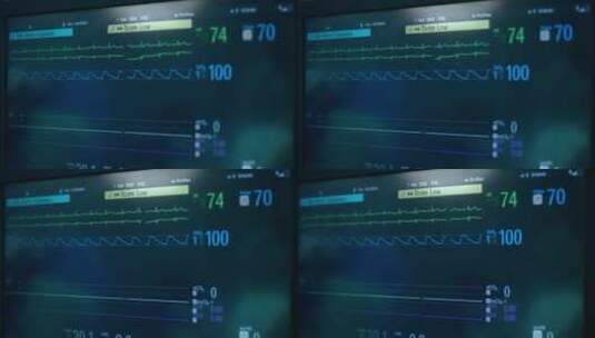 医院的心电图机机器高清在线视频素材下载