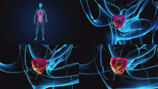4K前列腺癌的抽象3D动画高清在线视频素材下载