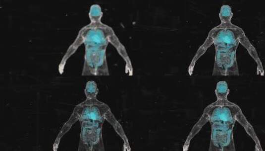 身体生物科技人体扫描点模型蓝色三维渲染高清在线视频素材下载