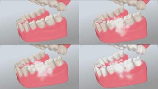 清理牙齿三维高清在线视频素材下载