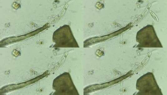 科研科普素材 死去的线虫被细菌围绕高清在线视频素材下载