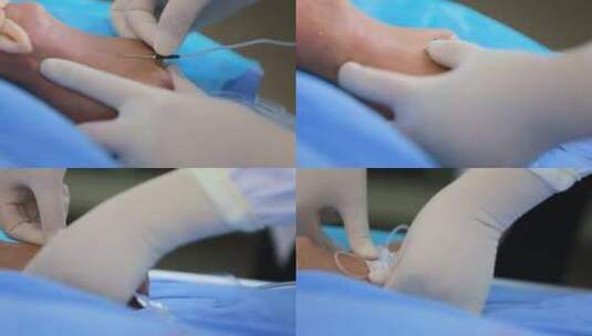 护士给病人扎针输液高清在线视频素材下载