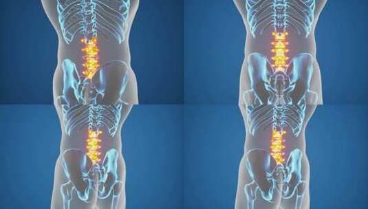 医疗-3D-动画-下背部-脊椎-疼痛高清在线视频素材下载