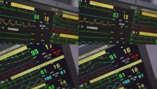 ICU重症监护仪 医疗 心电图高清在线视频素材下载