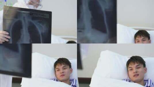 医生给患者查看X光片高清在线视频素材下载
