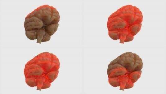 大脑、扫描、激光、科学高清在线视频素材下载