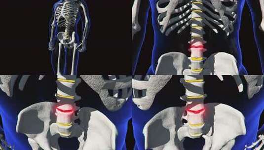 膝盖关节疼痛头颈腰椎人体骨骼3D动画高清在线视频素材下载