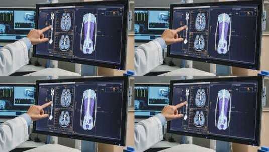 医生指认电脑人体解剖图像高清在线视频素材下载