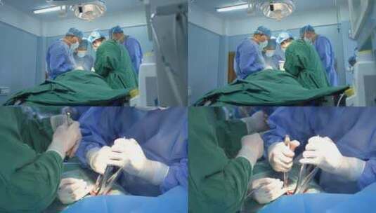 医院宣传片素材 外二科人医生为患者做手术高清在线视频素材下载