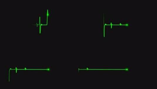 心电图显示心跳线心电图心搏高清在线视频素材下载