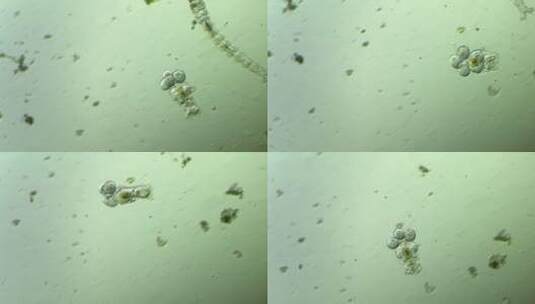 生命科学纪录片素材，显微镜下的生物，轮虫2高清在线视频素材下载