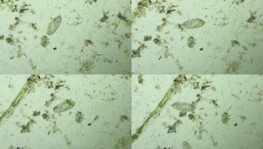 显微镜下的微观世界，草履虫8高清在线视频素材下载