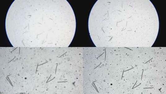 海绵骨针显微镜放大高清在线视频素材下载