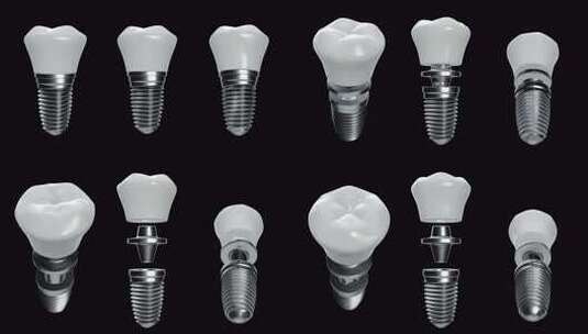 钛牙种植体。高清在线视频素材下载