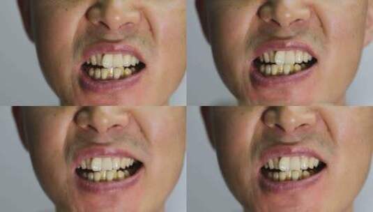 不整齐的牙齿高清在线视频素材下载