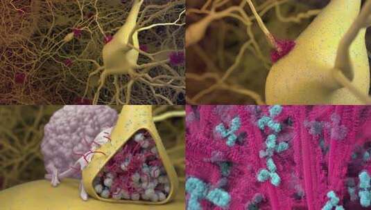神经系统器官细胞细菌感染3D高清在线视频素材下载