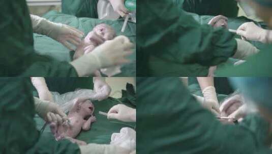 新生儿脐带处理婴儿啼哭高清在线视频素材下载