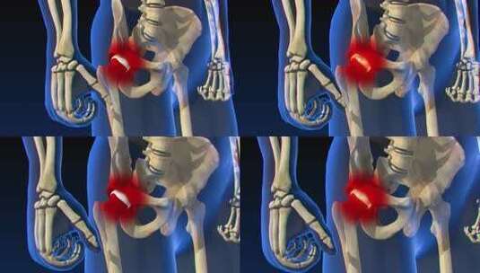 膝盖关节疼痛头颈腰椎人体骨骼3D动画高清在线视频素材下载