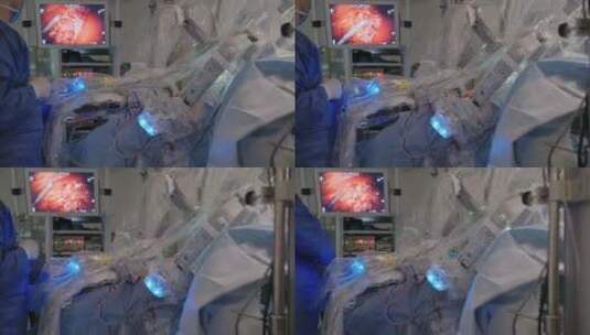 医院的微创机器人手术高清在线视频素材下载