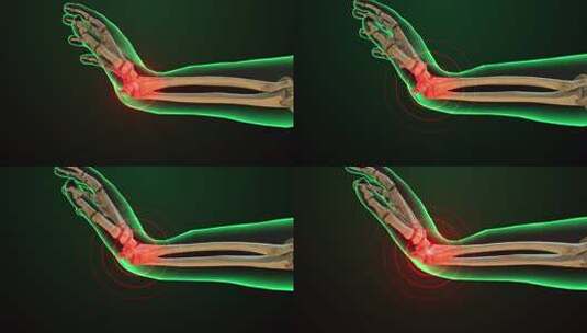膝盖关节疼痛头颈腰椎人体骨骼3D动画高清在线视频素材下载