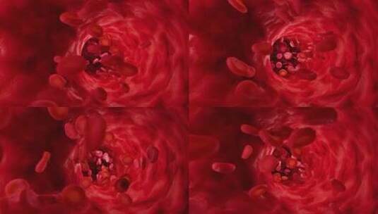 血小板 红细胞 细胞高清在线视频素材下载