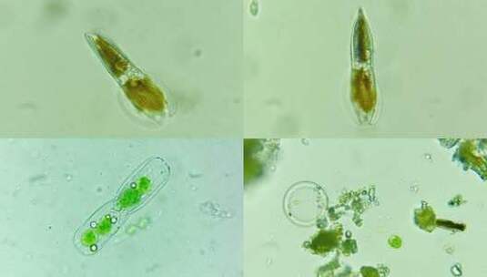 显微摄影 微生物硅藻合集高清在线视频素材下载