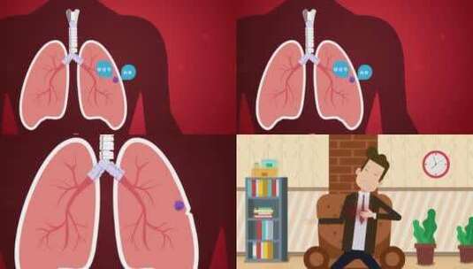 肺部疾病讲解mg动画高清在线视频素材下载