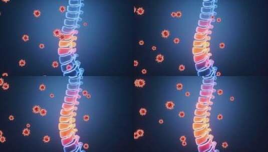 人类脊椎脊柱发炎感染和病毒动画高清在线视频素材下载