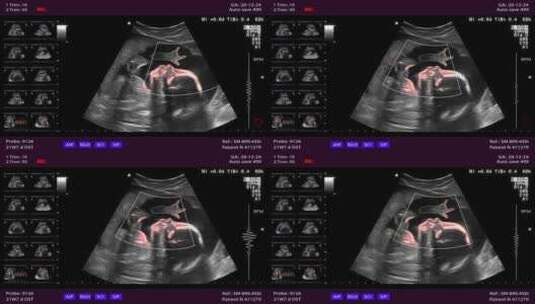 现代医学超声扫描或超声检查高清在线视频素材下载