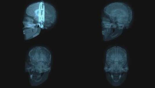 头骨的三维抽象艺术动态设计高清在线视频素材下载