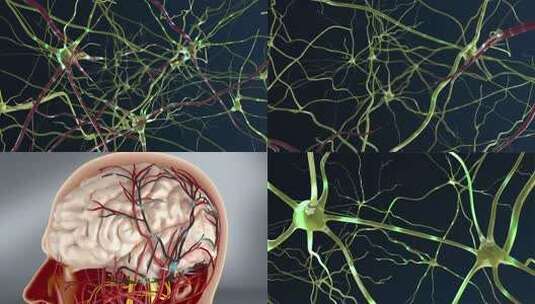 特写神经 大脑皮层 修复断裂的脑神经高清在线视频素材下载
