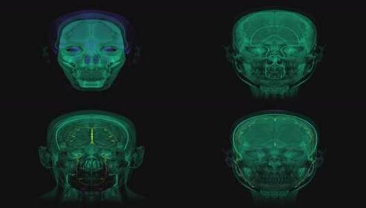 医疗头部大脑X光扫描赛博朋克HUD元素视频3高清在线视频素材下载