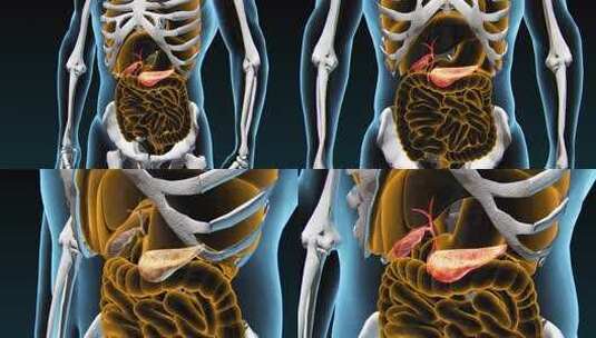 胰腺癌解剖图和胰腺疾病高清在线视频素材下载