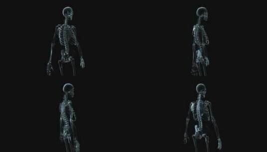 人体钢架旋转的3D医学动画高清在线视频素材下载