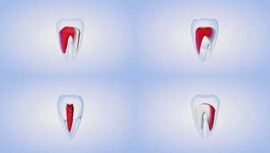 牙齿医疗模型高清在线视频素材下载