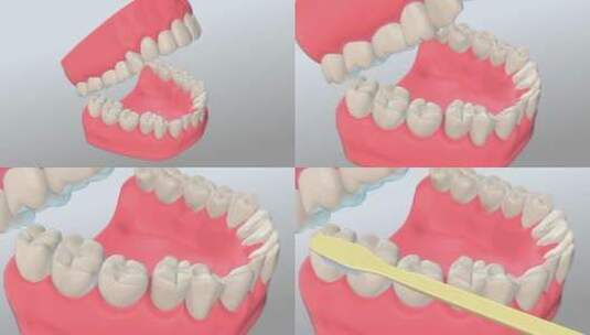 （带模型）三维牙齿刷牙工程ae模板高清AE视频素材下载