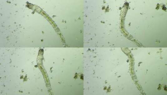 生命科学纪录片素材，显微镜下的摇蚊幼虫1高清在线视频素材下载