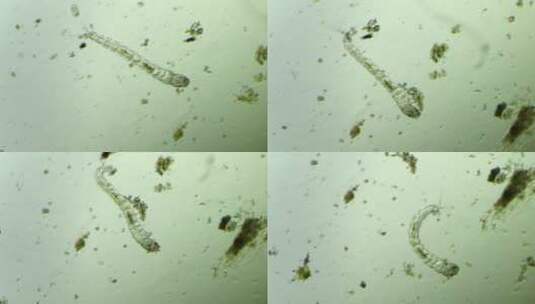 生命科学纪录片素材，显微镜下的摇蚊幼虫2高清在线视频素材下载