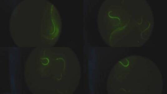 放大镜下的微生物高清在线视频素材下载