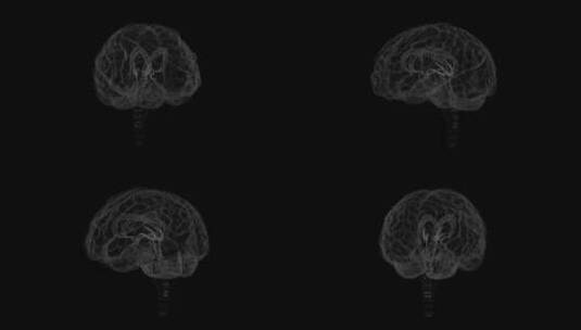 医学 大脑 脑科学 三维 脑ct1 模型高清在线视频素材下载