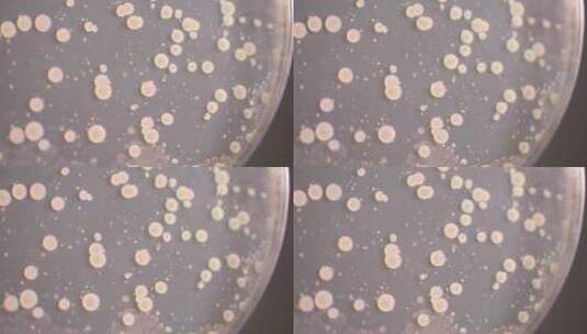 细菌培养基菌群检测细菌检测培养皿高清在线视频素材下载