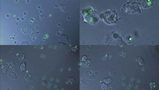 显微镜下白细胞吞噬细菌高清在线视频素材下载