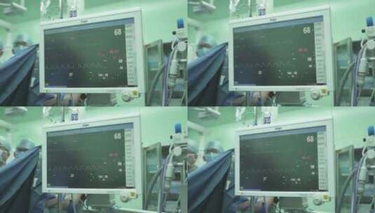医院 手术室 监测仪器 心电图高清在线视频素材下载