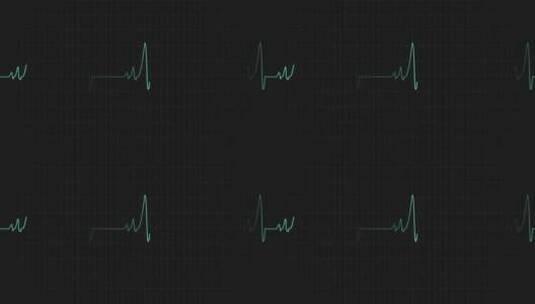 心电波形高清在线视频素材下载