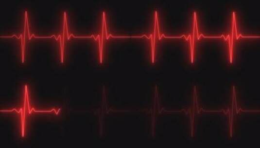 心电图 1心跳监护 心率 心律波谱波纹波普线高清在线视频素材下载