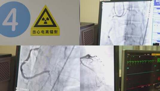 6864 医生 手术室 造影 X光机高清在线视频素材下载