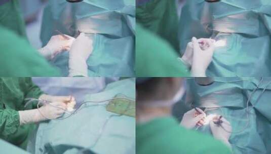 医生在手术高清在线视频素材下载