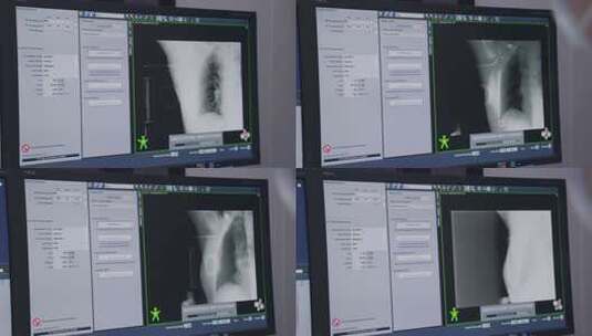医生操作电脑屏幕放疗高清在线视频素材下载