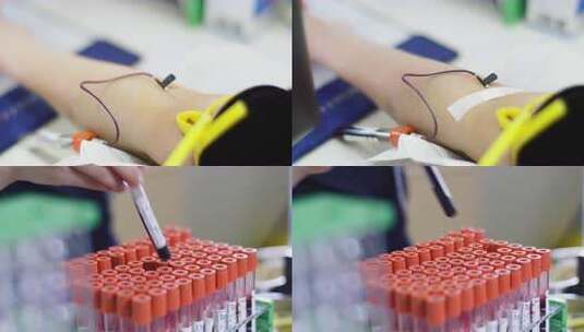 抽血特写高清在线视频素材下载